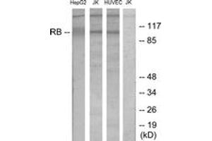 Western blot analysis of extracts from HepG2/Jurkat/HuvEc cells, using Retinoblastoma (Ab-780) Antibody. (Retinoblastoma Protein (Rb) anticorps  (AA 751-800))