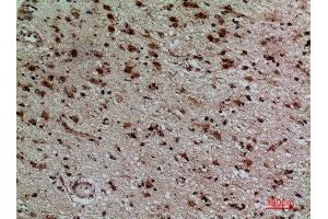 Immunohistochemistry (IHC) analysis of paraffin-embedded Human Brain, antibody was diluted at 1:100.