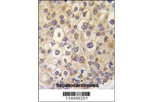 Immunohistochemistry (IHC) image for anti-rho Family GTPase 3 (RND3) (Center) antibody (ABIN2496515)