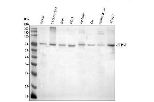 Western blot analysis of SHP2/PTPN11 using anti-SHP2/PTPN11 antibody (ABIN3043912).