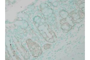 Immunohistochemistry analysis using Rabbit Anti-Ubiquitin Polyclonal Antibody .