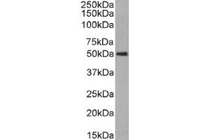 Western Blot using anti-CD63 antibody NK-1-C3. (Recombinant CD63 anticorps)