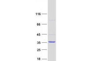 Validation with Western Blot