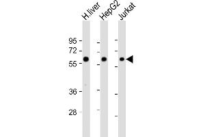 All lanes : Anti-CYP2E1 Antibody (Center) at 1:4000 dilution Lane 1: human liver lysate Lane 2: HepG2 whole cell lysate Lane 3: Jurkat whole cell lysate Lysates/proteins at 20 μg per lane.