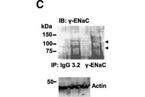 Western blots showing Cav3.