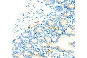 Immunohistochemistry of paraffin embedded mouse small intestine using MADCAM1 (ABIN7074695) at dilution of 1:1800 (400x lens) (MADCAM1 anticorps)