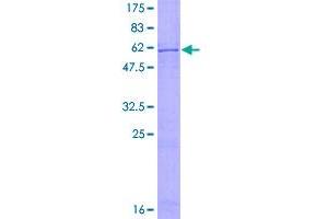Image no. 1 for Cyclin-Dependent Kinase 5 (CDK5) (AA 1-292) protein (GST tag) (ABIN1348956)