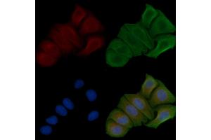 ABIN6257896 and ABIN6274807 staining Hela cells by IF/ICC. (ACOT8 anticorps  (Internal Region))