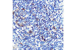 Immunohistochemistry of paraffin-embedded human spleen using HLA-DRA Rabbit mAb (ABIN7267758) at dilution of 1:100 (40x lens). (HLA-DRA anticorps)