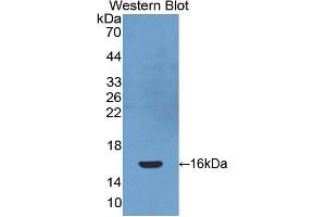 Western blot analysis of the recombinant protein. (PDGFC anticorps  (AA 235-345))