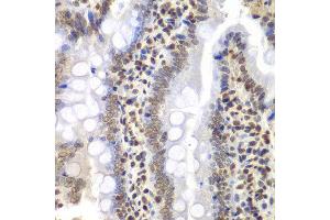 Immunohistochemistry (IHC) image for anti-Proteasome (Prosome, Macropain) 26S Subunit, ATPase, 3 (PSMC3) (AA 1-180) antibody (ABIN3022705)