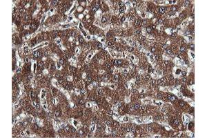 Image no. 3 for anti-Phosphatidylinositol-4-Phosphate 3-Kinase, Catalytic Subunit Type 2 beta (PIK3C2B) antibody (ABIN1500199)