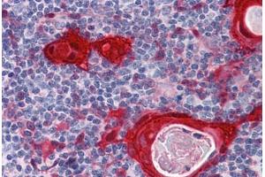 Human Thymus: Formalin-Fixed, Paraffin-Embedded (FFPE)