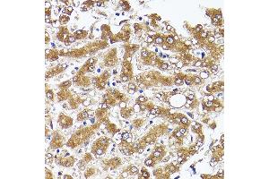Immunohistochemistry of paraffin-embedded human liver using  Rabbit pAb (ABIN7265370) at dilution of 1:50 (40x lens).