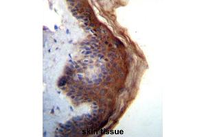 Immunohistochemistry (IHC) image for anti-Interleukin 1 delta (FIL1d) antibody (ABIN5016258) (FIL1d anticorps)