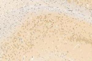 Immunohistochemistry analysis of paraffin-embedded mouse brain using,Neuroligin 3 (ABIN7074816) at dilution of 1: 1200 (Neuroligin 3 anticorps)