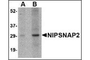 Western blot analysis of NIPSNAP2 in human skeletal muscle tissue lysate with this product at (A) 1 and (B) 2 μg/ml. (GBAS anticorps  (Center))