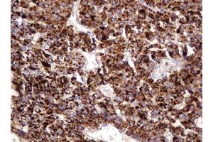 Image no. 4 for anti-Integrin alpha FG-GAP Repeat Containing 3 (ITFG3) antibody (ABIN1498916)