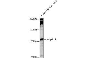 Western blot analysis of extracts of Mouse skeletal muscle, using Nesprin 1 antibody (ABIN7270520) at 1:1000 dilution. (SYNE1 anticorps)