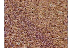 IHC image of ABIN7139916 diluted at 1:100 and staining in paraffin-embedded human tonsil tissue performed on a Leica BondTM system. (LPAR5 anticorps  (AA 310-326))
