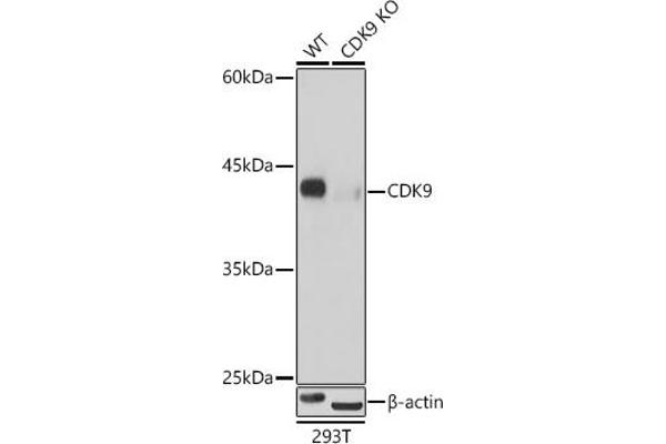 CDK9 anticorps