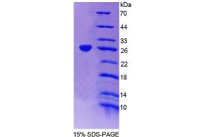 SDS-PAGE analysis of Human EPRS Protein. (EPRS Protéine)