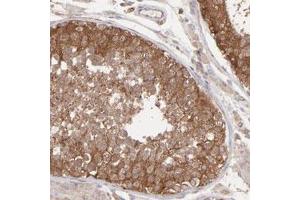 Immunohistochemical staining (Formalin-fixed paraffin-embedded sections) of human testis with MAPRE1 polyclonal antibody  shows strong cytoplasmic positivity in cells of seminiferous ducts.