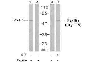 Image no. 1 for anti-Paxillin (PXN) (pTyr118) antibody (ABIN196776) (Paxillin anticorps  (pTyr118))