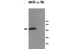 Western Blotting (WB) image for anti-Tubulin, gamma 1 (TUBG1) (C-Term) antibody (ABIN2451983) (TUBG1 anticorps  (C-Term))