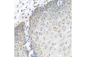 Immunohistochemistry of paraffin-embedded human esophagus using TMOD3 antibody (ABIN5972684) at dilution of 1/100 (40x lens). (TMOD3 anticorps)