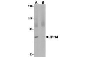 Image no. 1 for anti-Junctophilin 4 (JPH4) (C-Term) antibody (ABIN341700) (Junctophilin 4 anticorps  (C-Term))