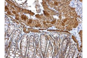 IHC-P Image alpha smooth muscle Actin antibody detects alpha smooth muscle Actin protein at cytosol on mouse colon by immunohistochemical analysis. (Smooth Muscle Actin anticorps  (N-Term))
