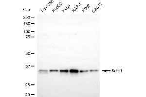 Western blotting analysis using Seh1L antibody (ABIN7800290). (Recombinant SEH1L anticorps)