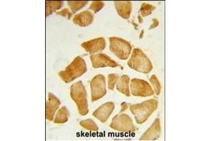 Formalin-fixed and paraffin-embedded human skeletal muscle reacted with ANP32A Antibody (C-term), which was peroxidase-conjugated to the secondary antibody, followed by DAB staining.