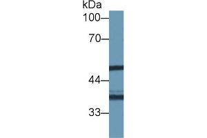 Western blot analysis of Human HeLa cell lysate, using Mouse NAT1 Antibody (1 µg/ml) and HRP-conjugated Goat Anti-Rabbit antibody ( (NAT1 anticorps  (AA 9-254))