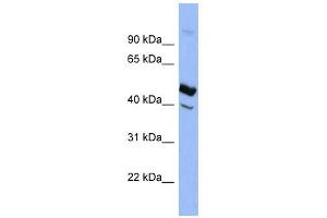 SERPIND1 antibody used at 1 ug/ml to detect target protein. (SERPIND1 anticorps)