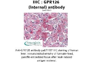 Image no. 1 for anti-G Protein-Coupled Receptor 126 (GPR126) (Internal Region) antibody (ABIN1734924) (G Protein-Coupled Receptor 126 anticorps  (Internal Region))