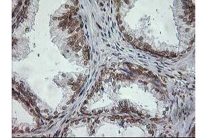 anti-Signal Sequence Receptor, alpha (SSR1) antibody