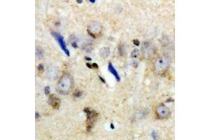 Immunohistochemical analysis of LC3A staining in human brain formalin fixed paraffin embedded tissue section. (MAP1LC3A anticorps)