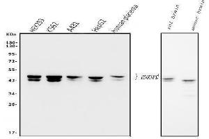 Western blot analysis of hnRNP D/AUF1/HNRNPD using anti-hnRNP D/AUF1/HNRNPD antibody (ABIN7602591). (HNRNPD/AUF1 anticorps  (AA 88-246))