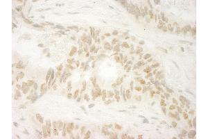 Immunohistochemistry (IHC) image for anti-Makorin Ring Finger Protein 1 (MKRN1) (C-Term) antibody (ABIN7448670)