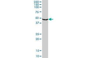 UPB1 monoclonal antibody (M09), clone 3F12.
