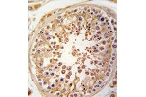 Formalin-fixed and paraffin-embedded human testis tissue reacted with SPAG9 antibody (N-term) , which was peroxidase-conjugated to the secondary antibody, followed by DAB staining.