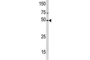 Western blot analysis of PXK antibody and HeLa lysate