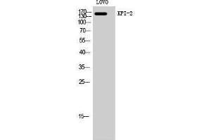 Western Blotting (WB) image for anti-Lemur tyrosine Kinase 2 (LMTK2) (Internal Region) antibody (ABIN3185318)