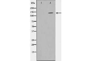 Western blot analysis on HepG2 cell lysate using SHIP1 Antibody,The lane on the left is treated with the antigen-specific peptide.