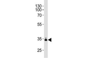 Western blot analysis of lysate from human plasma tissue lysate using ApoE antibody diluted at 1:1000.