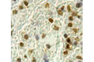 Used in DAB staining on fromalin fixed paraffin-embedded Spleen tissue