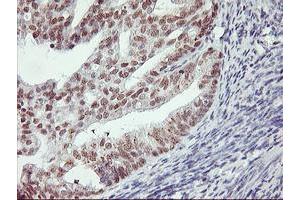 Image no. 3 for anti-Ring Finger Protein 113B (RNF113B) antibody (ABIN1500718) (RNF113B anticorps)