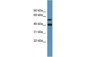Western Blotting (WB) image for anti-Damage-Specific DNA Binding Protein 2, 48kDa (DDB2) (C-Term) antibody (ABIN2788357)